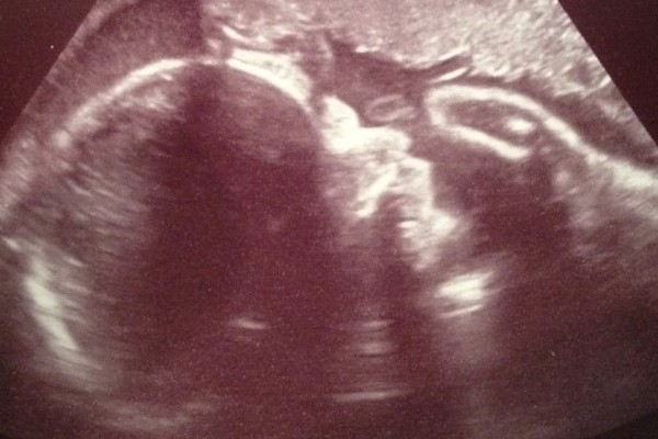 29 Weeks Pregnant