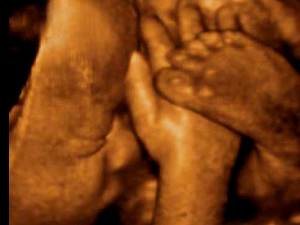 32 Weeks Pregnant