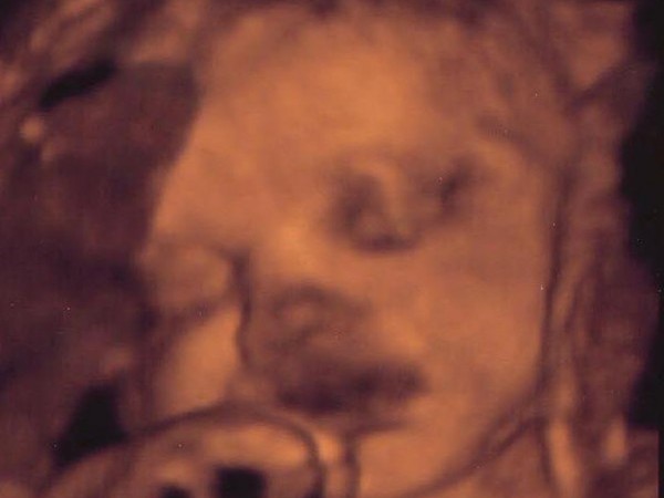 34 Weeks Pregnant