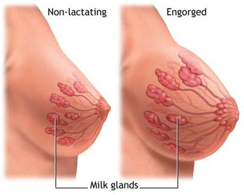 pregnancy-breasts